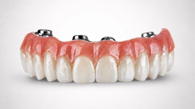 modern dentures