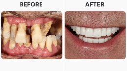 long ugly teeth transformed