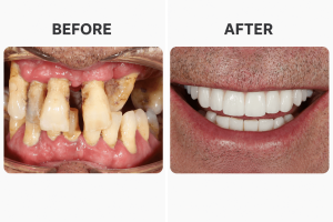 long ugly teeth transformed